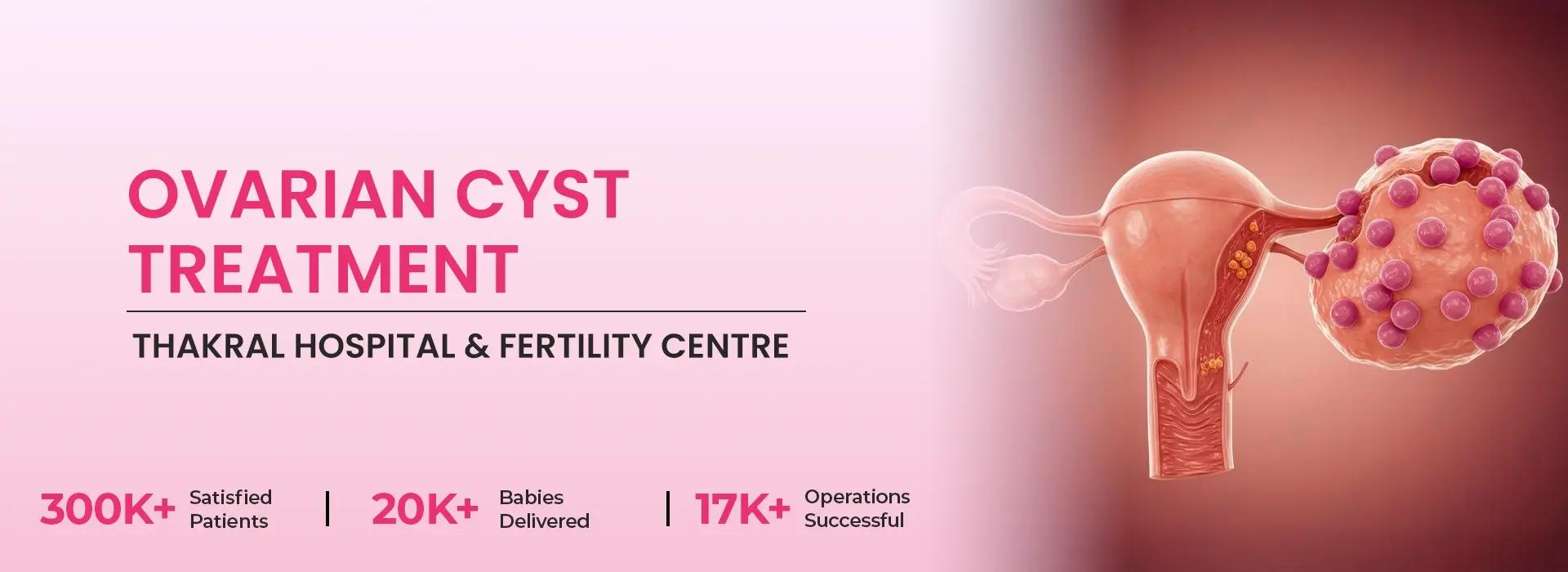Best IUI treatment in Gurgaon